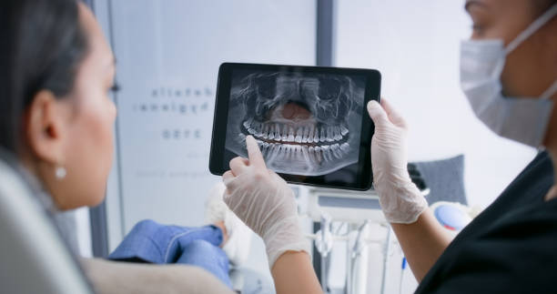 Licensed Teeth Whitening service in Lake Lakengren, OH - Smile Center Dentistry